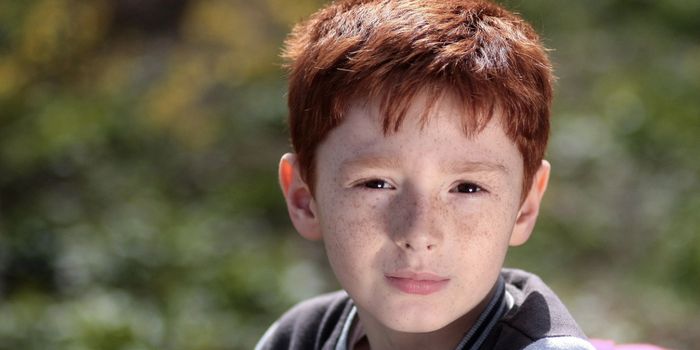 Understanding Why Redheads Perceive Pain Differently