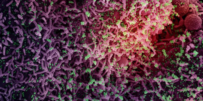 COVID-19 Tests & What to do About a Positive Result