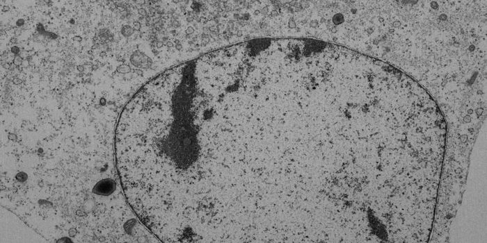 Ferroptosis - New Details on a Type of Cell Death