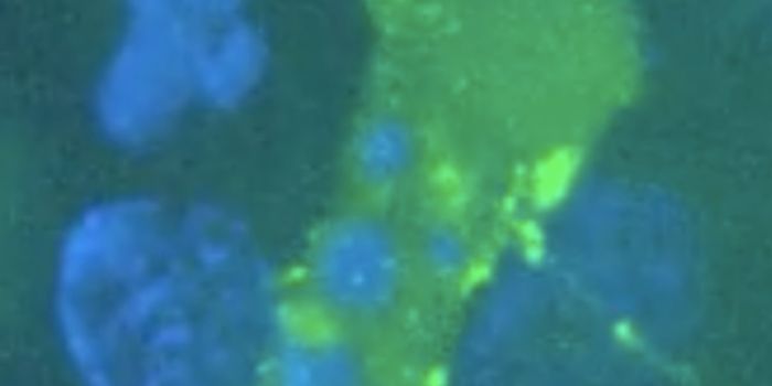 HIV Caught on Camera Infecting Cells