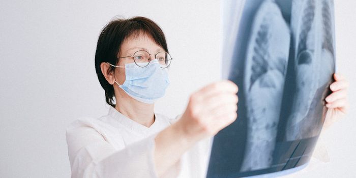 New PET Scan Approach for Detecting tuberculosis