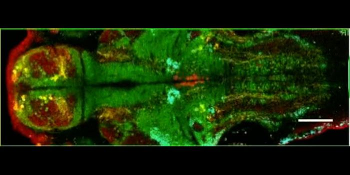 New Methods Reveal More About Brain's Mysteries