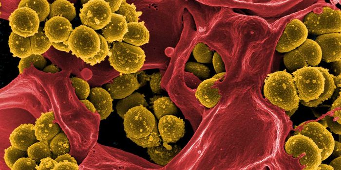 Silver to the rescue!