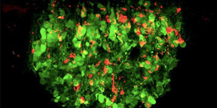 How the Gut Tells the Brain About Thirst