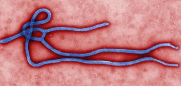 Novel Retinal Scar ID'ed in Ebola Survivors