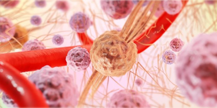 Engineered Immune Cells Improves Anti-Cancer Response