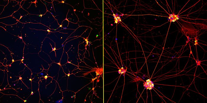 Stem Cell-Derived Neurons Reaching Maturity Thanks to Dynamic Nanofibers