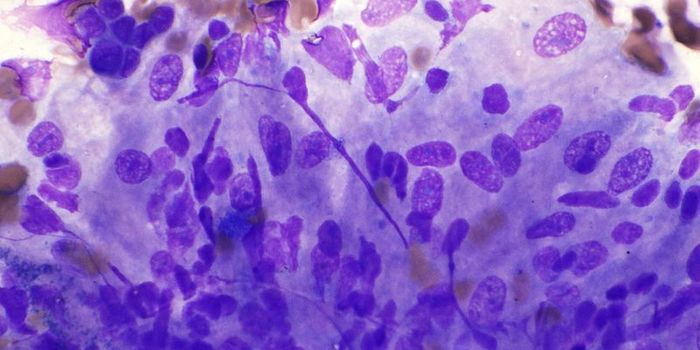 Neural Miscommunication in the Lungs Amplifies Allergic Inflammation