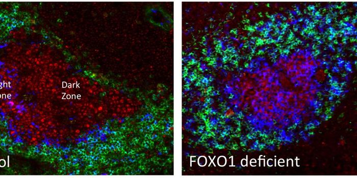 Light Zones, Dark Zones, and Lymphoma Formation