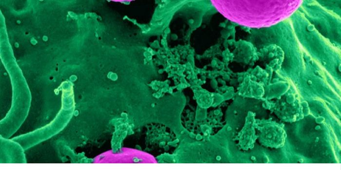 Cancer Metastasis Caught on Film