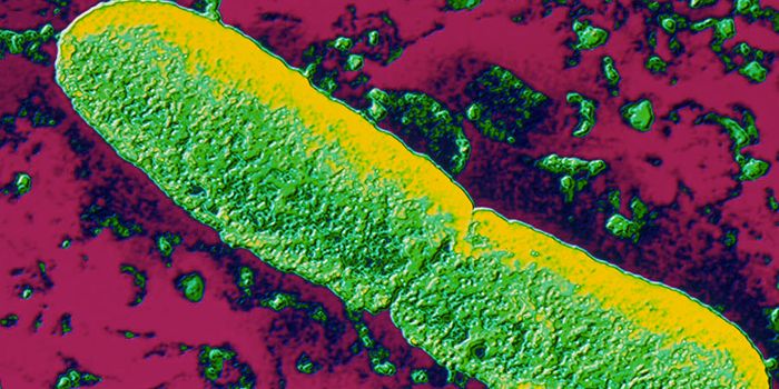 Better Know a Microbe: Yersinia pestis