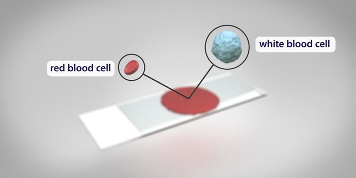 The Basics of Blood Cancers