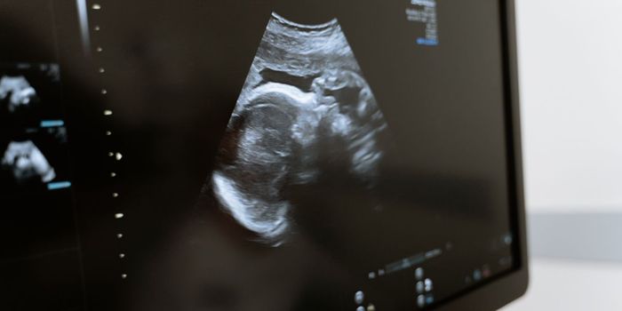 Women with Autoimmune Disease 30% More Likely to Have Perinatal Depression