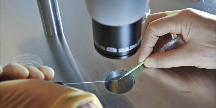 Screening IVF Embryos for Low IQ