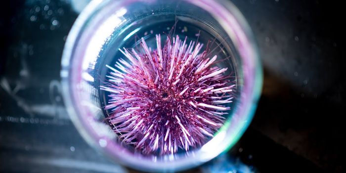 Why Noah's Ark is a Bad Strategy