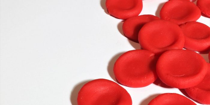 Whole Blood Exchange May Reduce Amyloid Plaques in Alzheimer's