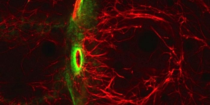 Insect Analogue for Intermediate Filaments Discovered