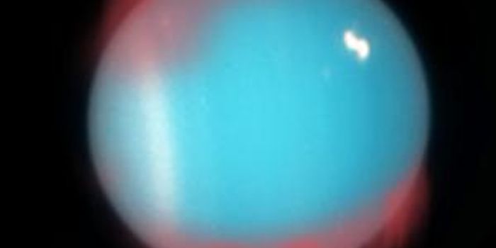 Infrared Aurora Confirmed on Uranus: A Breakthrough in Planetary Magnetic Field Studies