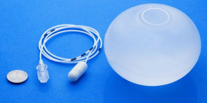 A Swallowable Water Balloon For Weight Loss