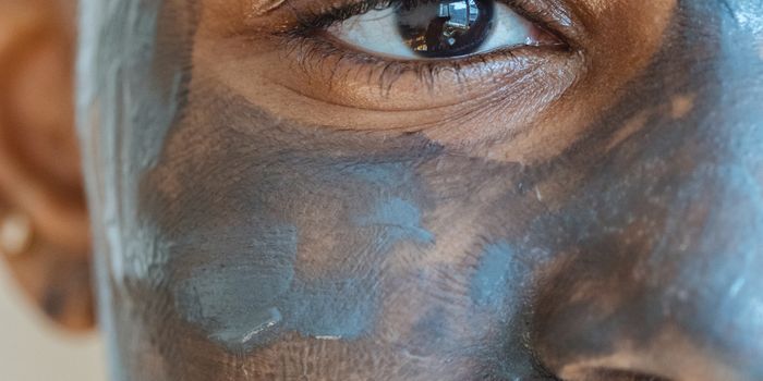 Genome-wide association study increases understanding of the genetic basis of acne