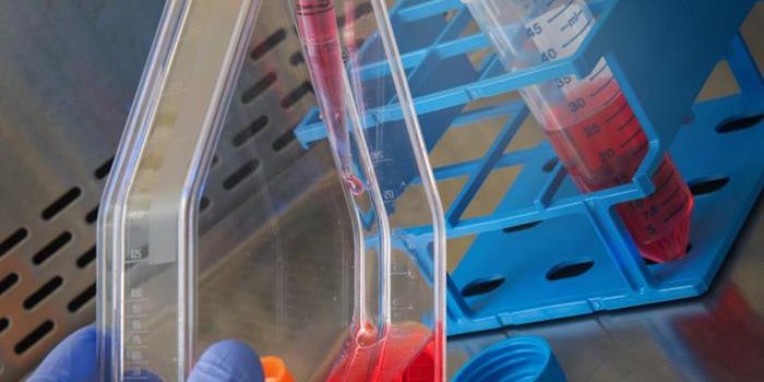 Good Results From Trial of CAR T Cell Therapy for Non-Hodgkin Lymphoma