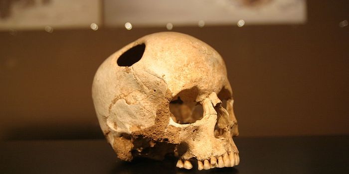 Brain Surgery Debate Settled: To Replace or Not to Replace the Skull Flap?