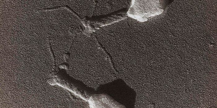 How a Virus Can Help Treat Alcoholic Liver Disease