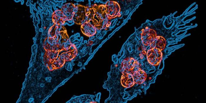 "Hungry Like the Macrophage" from Koch Institute Image Awards