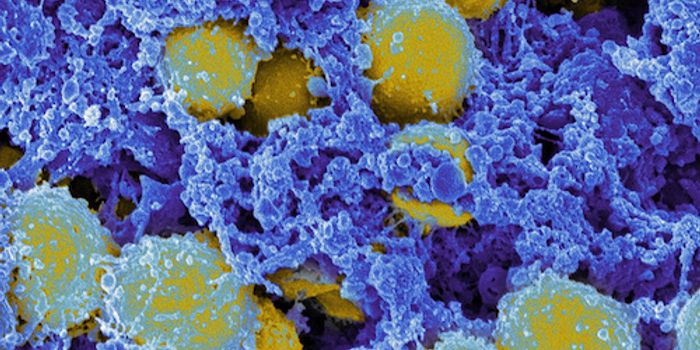 A Kind of Forensics to ID the Source of Bacterial Outbreaks