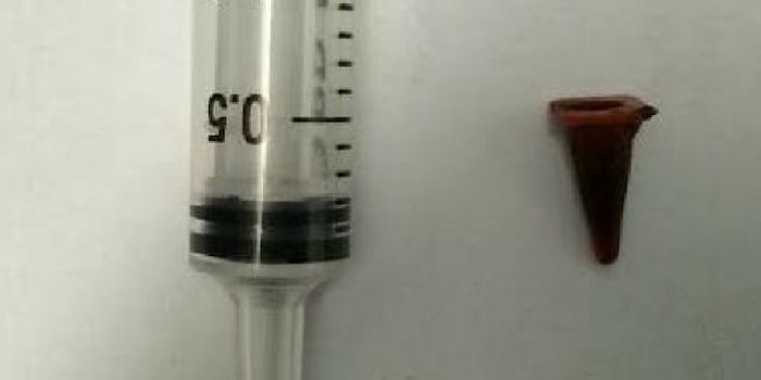 Diagnosed: Swallowed Toy, Not Lung Cancer