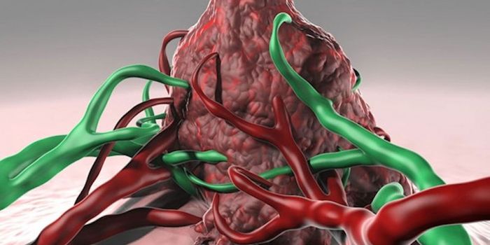 Personalized Cancer Vaccines Show Promise in Study