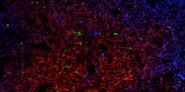 FOXP3 Mutations Lead to Autoimmune Disease, But Scientists Have An Answer