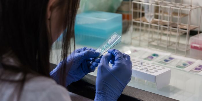 Targeting Prostate Specific Membrane Antigens in Renal Cell Carcinoma