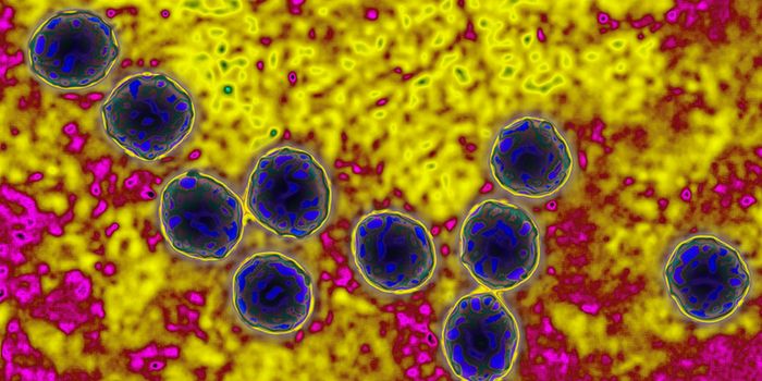 CNS Tumor Cells Destroyed by Zika Virus