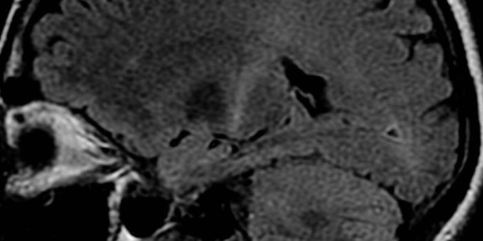 New Experimental Model for ALS and MS Immunotherapies