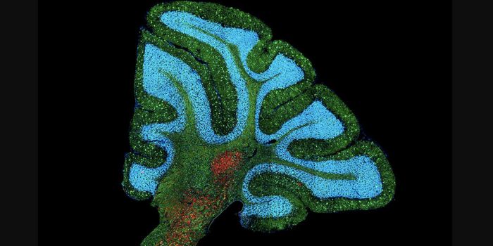 Experimental Drug Slows Progression of Rare Genetic Disease