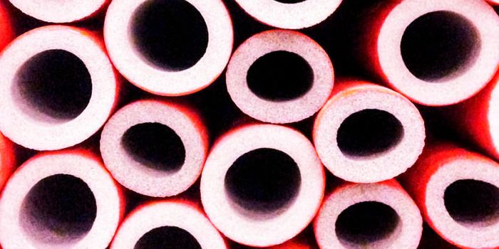 Could a ‘youthful' protein protect arteries from plaque?