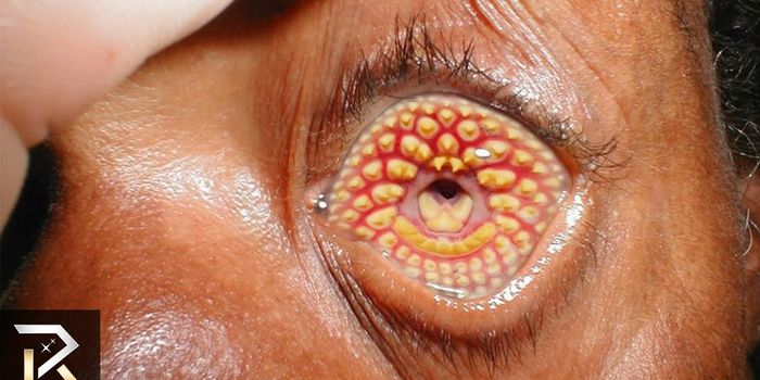 10 Terrifying Modern Day Epidemics