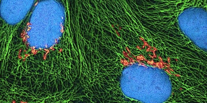 Stopping Cell Suicide