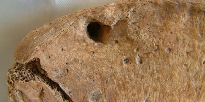 Scientists Find the First Evidence of a Lion Bite on a Gladiator