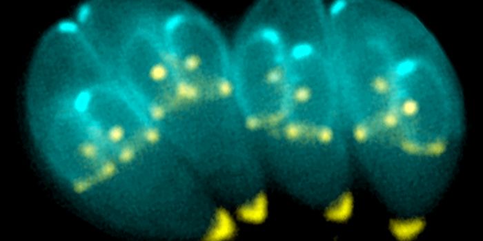 Toxoplasma wreaks havoc on neurons