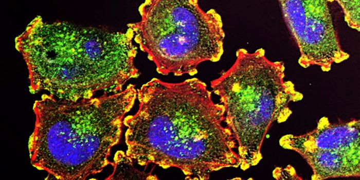 CBD Kills Brain Cancer Cells in Petri Dish