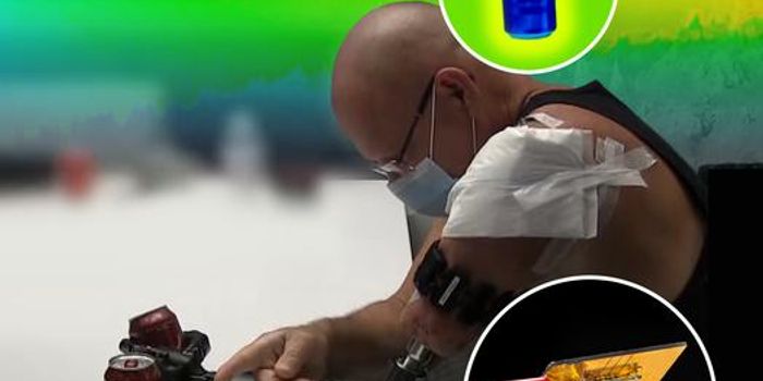 Restoring Temperature Sensation in Prosthetic Limbs: A Collaborative Study