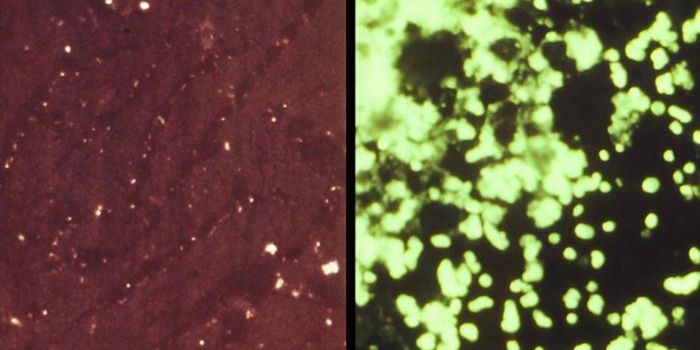 A Closer Look at a Potential Bioweapon