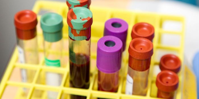 The Antibody Test to See if You've Already Had the Coronavirus