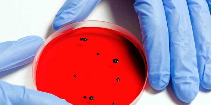 Could Cannabis-Based Compounds Be the Next New Class of Antibiotics?