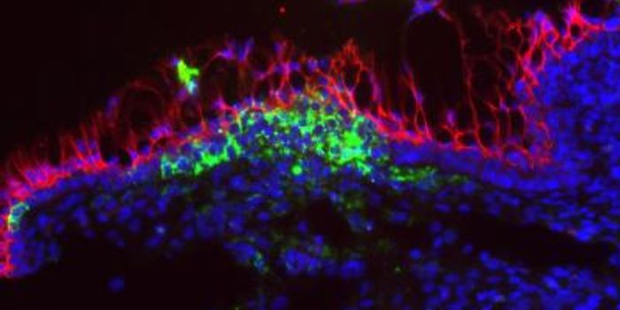 Why are women at a greater risk for Zika infection?