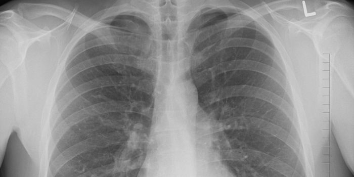 Epigenetic Changes May Increase Asthma Risk