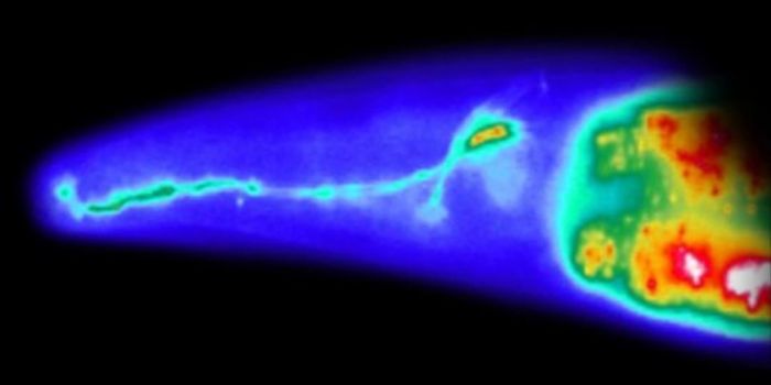 Risky Business: Dopamine and the Brain