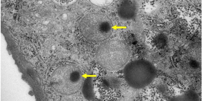 Insight Into the Maturation of Giant Viruses